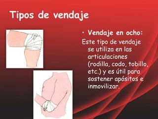 Tipos de vendaje
• Vendaje en ocho:
Este tipo de vendaje
se utiliza en las
articulaciones
(rodilla, codo, tobillo,
etc.) y es útil para
sostener apósitos e
inmovilizar.
 