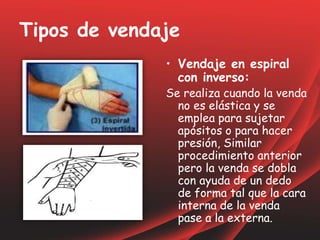 Tipos de vendaje
• Vendaje en espiral
con inverso:
Se realiza cuando la venda
no es elástica y se
emplea para sujetar
apósitos o para hacer
presión, Similar
procedimiento anterior
pero la venda se dobla
con ayuda de un dedo
de forma tal que la cara
interna de la venda
pase a la externa.
 