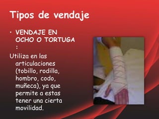 Tipos de vendaje
• VENDAJE EN
OCHO O TORTUGA
:
Utiliza en las
articulaciones
(tobillo, rodilla,
hombro, codo,
muñeca), ya que
permite a estas
tener una cierta
movilidad.
 
