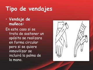 Tipo de vendajes
• Vendaje de
muñeca:
En este caso si se
trata de sostener un
apósito se realizara
en forma circular
pero si se quiere
inmovilizar se
incluirá la palma de
la mano.
 