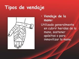 Tipos de vendaje
• Vendaje de la
mano:
Utilizado generalmente
en cubrir heridas de la
mano, sostener
apósitos o para
inmovilizar la mano.
 