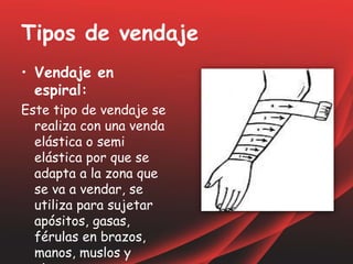 Tipos de vendaje
• Vendaje en
espiral:
Este tipo de vendaje se
realiza con una venda
elástica o semi
elástica por que se
adapta a la zona que
se va a vendar, se
utiliza para sujetar
apósitos, gasas,
férulas en brazos,
manos, muslos y
 