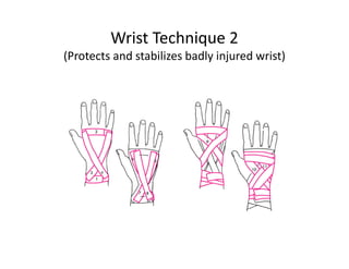Wrist Technique 2
(Protects and stabilizes badly injured wrist)
 