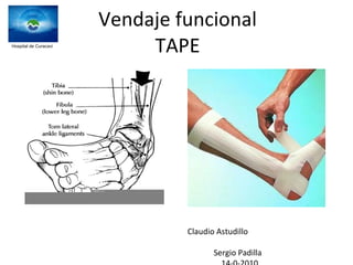 Vendaje funcional TAPE Claudio Astudillo  Sergio Padilla 14-0-2010 Hospital de Curacavi 