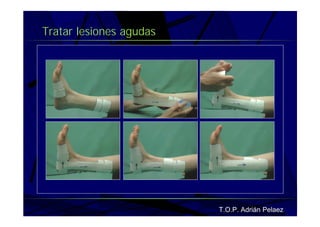 Vendaje Funcional Pie