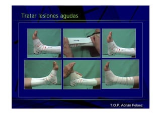 Vendaje Funcional Pie