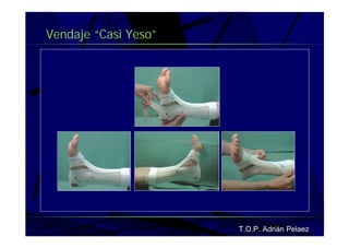 Vendaje Funcional Pie