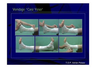 Vendaje Funcional Pie