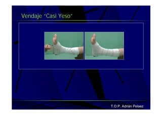 Vendaje Funcional Pie