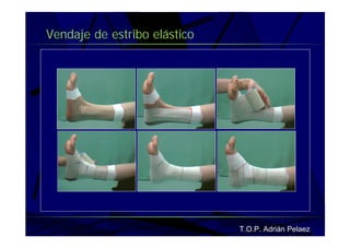 Vendaje Funcional Pie