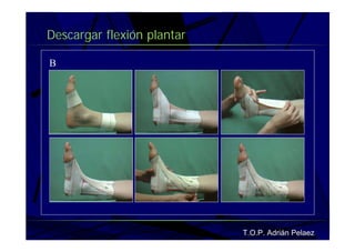 Vendaje Funcional Pie