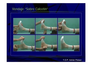 Vendaje Funcional Pie