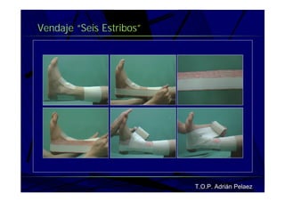 Vendaje Funcional Pie