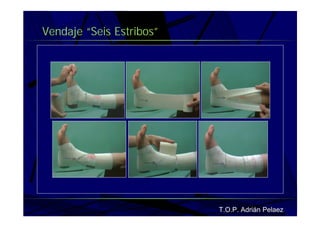 Vendaje Funcional Pie