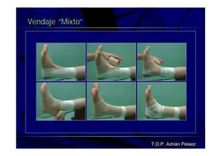 Vendaje Funcional Pie