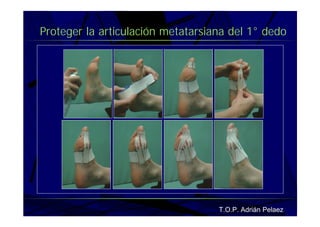 Vendaje Funcional Pie