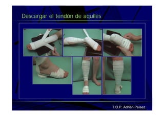 Vendaje Funcional Pie