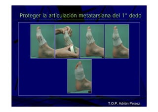 Vendaje Funcional Pie