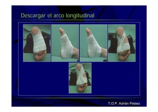 Vendaje Funcional Pie