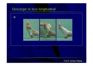 Vendaje Funcional Pie