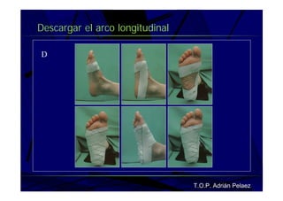 Vendaje Funcional Pie