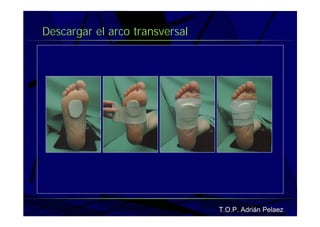 Vendaje Funcional Pie