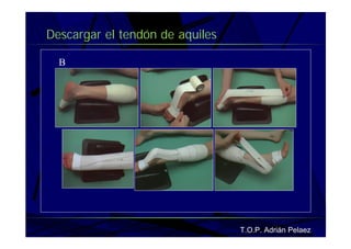 Vendaje Funcional Pie