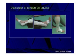 Vendaje Funcional Pie