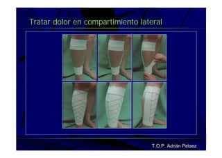 Vendaje Funcional Pie