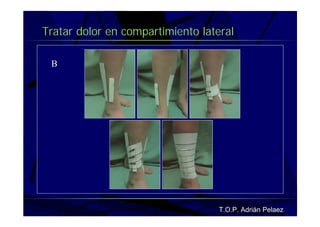 Vendaje Funcional Pie