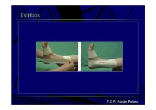 Vendaje Funcional Miembro Superior