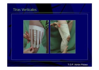 Vendaje Funcional Miembro Superior