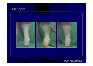 Vendaje Funcional Miembro Superior