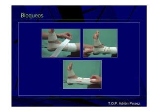 Vendaje Funcional Miembro Superior