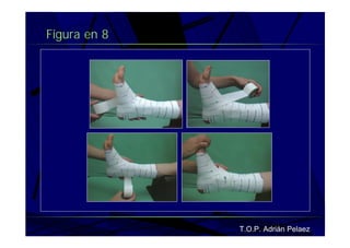 Vendaje Funcional Miembro Superior