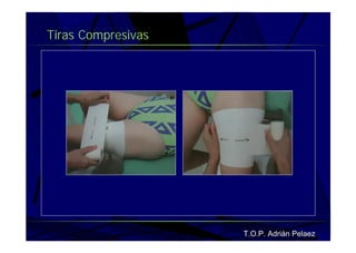 Vendaje Funcional Miembro Superior