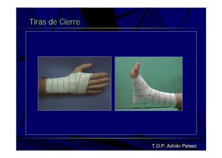 Vendaje Funcional Miembro Superior