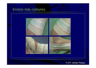 Vendaje Funcional Miembro Superior