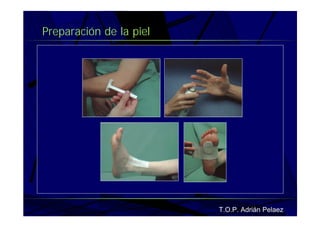 Vendaje Funcional Miembro Superior