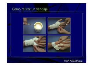 Vendaje Funcional Miembro Superior