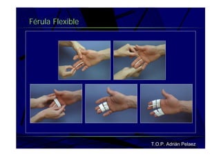 Vendaje Funcional Miembro Superior