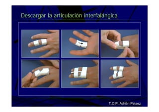 Vendaje Funcional Miembro Superior