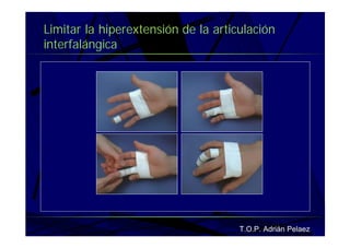 Vendaje Funcional Miembro Superior