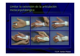 Vendaje Funcional Miembro Superior