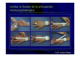 Vendaje Funcional Miembro Superior