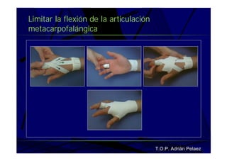 Vendaje Funcional Miembro Superior