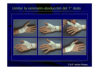 Vendaje Funcional Miembro Superior