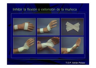 Vendaje Funcional Miembro Superior