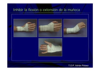 Vendaje Funcional Miembro Superior
