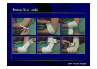 Vendaje Funcional Miembro Superior